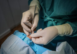 Cirugía podológica